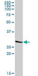 KCNIP3 Antibody in Western Blot (WB)