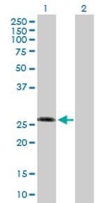 KCNIP3 Antibody in Western Blot (WB)