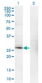 CSEN Monoclonal Antibody (2B3-A1)