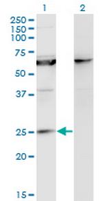 KCNIP1 Monoclonal Antibody (3D9)
