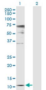 ZNRD1 Polyclonal Antibody, MaxPab™