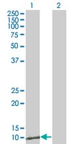 ZNRD1 Monoclonal Antibody (6C12)