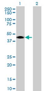 CD209 Antibody in Western Blot (WB)