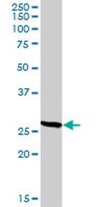 CD209 Antibody in Western Blot (WB)