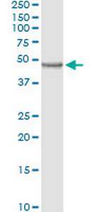 CD209 Antibody in Immunoprecipitation (IP)