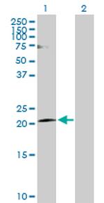 CLDN20 Polyclonal Antibody, MaxPab™