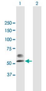 PLA2G3 Polyclonal Antibody, MaxPab™