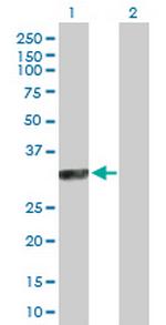SYCP3 Antibody in Western Blot (WB)