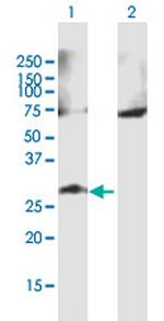 GALNT9 Polyclonal Antibody, MaxPab™
