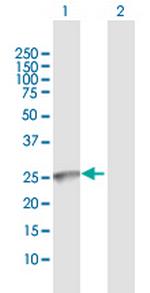 GALNT9 Antibody in Western Blot (WB)
