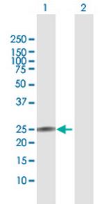 IL22 Antibody in Western Blot (WB)