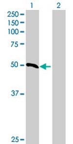 RDH8 Polyclonal Antibody, MaxPab™