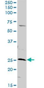 AK3 Antibody in Western Blot (WB)