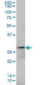AK3 Monoclonal Antibody (1D2)
