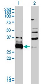 HDGFRP3 Monoclonal Antibody (2G12)