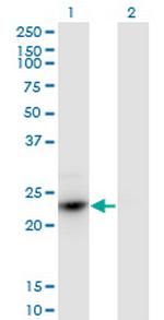 HDGFRP3 Monoclonal Antibody (1D1)