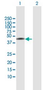 NSDHL Polyclonal Antibody, MaxPab™