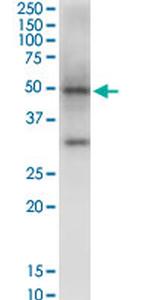 NSDHL Monoclonal Antibody (6E3)