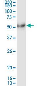 DHH Antibody in Western Blot (WB)