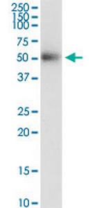 DHH Monoclonal Antibody (3E6)