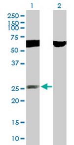 RNF141 Polyclonal Antibody, MaxPab™