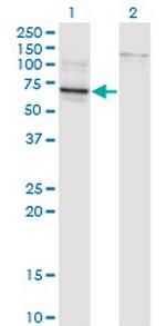 TBX22 Monoclonal Antibody (1A10)