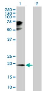 TPRKB Antibody in Western Blot (WB)