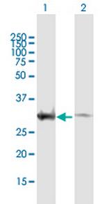 EXOSC3 Polyclonal Antibody, MaxPab™