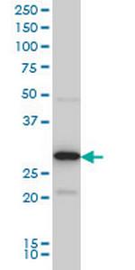 EXOSC3 Monoclonal Antibody (5C3)