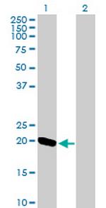 EXOSC1 Polyclonal Antibody, MaxPab™