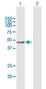VPS36 Polyclonal Antibody, MaxPab™