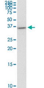 ZBTB7B Monoclonal Antibody (1D4)