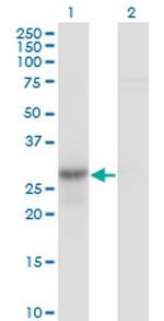 GMNN Monoclonal Antibody (1A8)