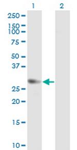 GMNN Monoclonal Antibody (1B10)