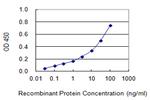 MLXIPL Monoclonal Antibody (5B2)