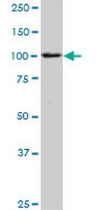 TNNI3K Antibody in Western Blot (WB)
