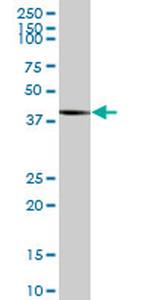 TRNT1 Antibody in Western Blot (WB)