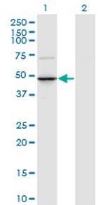 TRNT1 Monoclonal Antibody (1G11)