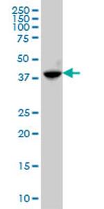 ABHD5 Monoclonal Antibody (4B12)