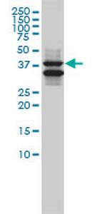 SH3GLB1 Monoclonal Antibody (1B3-A5)