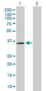 C8orf70 Polyclonal Antibody, MaxPab™