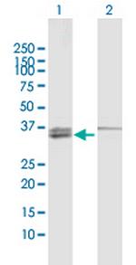 MECR Polyclonal Antibody, MaxPab™