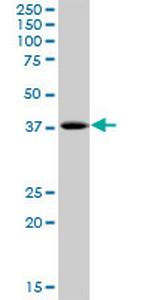 PHF20L1 Antibody in Western Blot (WB)
