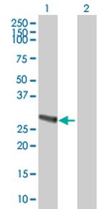 METTL9 Antibody in Western Blot (WB)