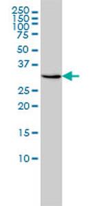 RDH11 Monoclonal Antibody (1H6)