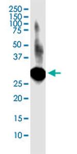 LACTB2 Monoclonal Antibody (1H3)