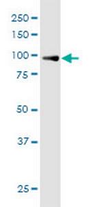 TTC15 Polyclonal Antibody, MaxPab™