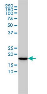 NAT5 Monoclonal Antibody (2C6)