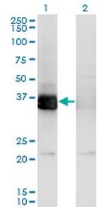 PHF11 Monoclonal Antibody (3B8)