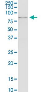 RNF12 Antibody in Western Blot (WB)